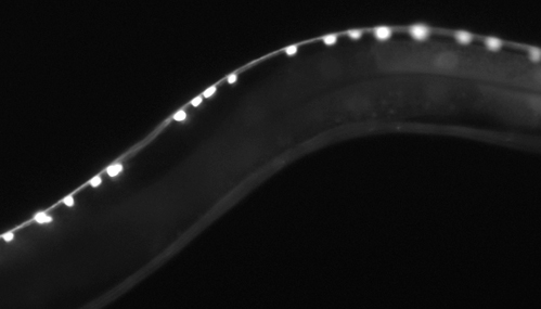 C. elegans Acetylcholine Neurons by Ashley Crisp