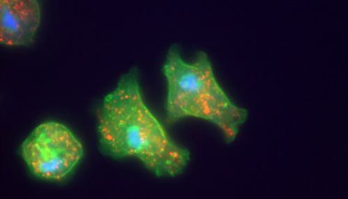 Dictyostelium amoeba by Rebecca Brady