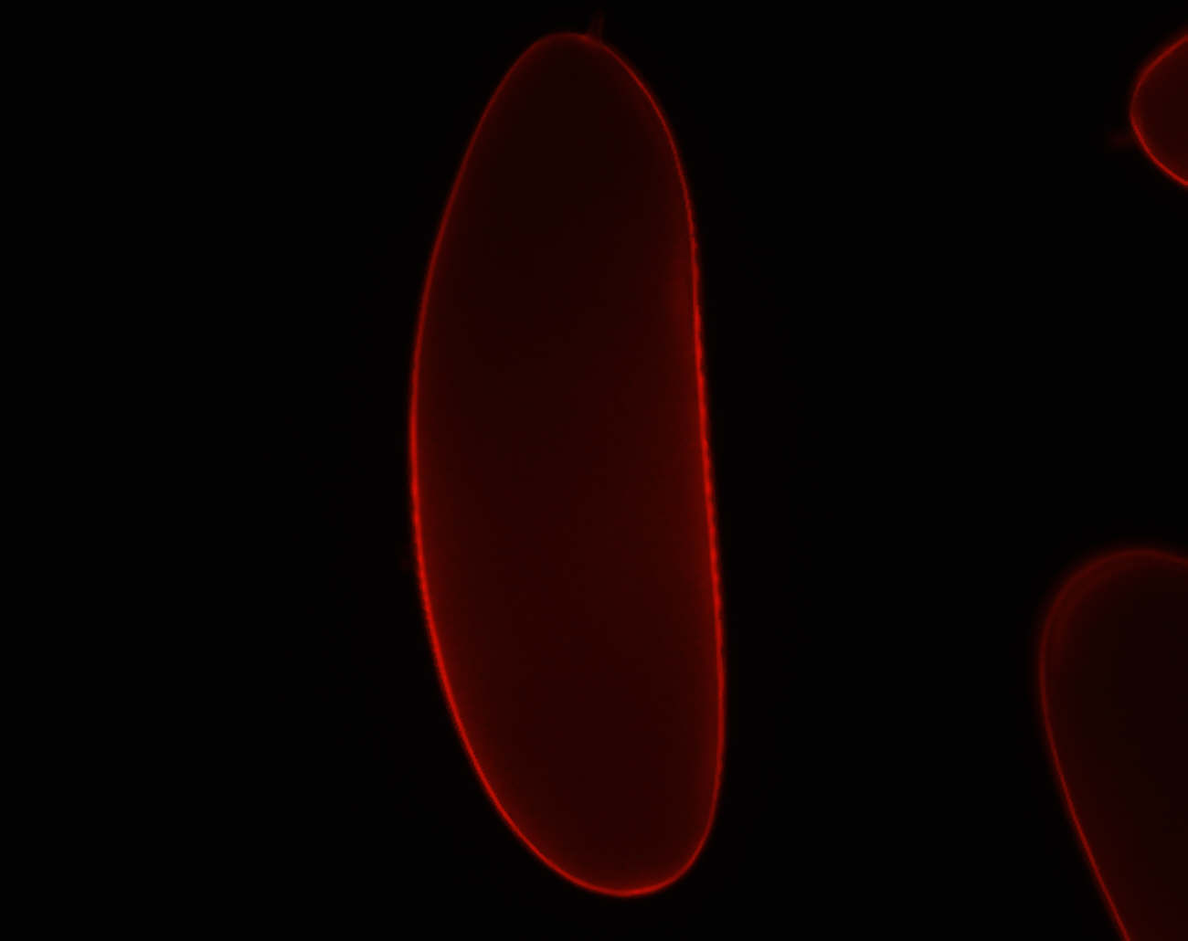 VML-RFP localizes to the Drosophila Eggshell