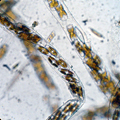 diatom of the genus Parlibellus
