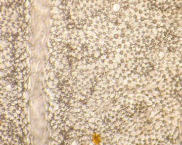 FRAL3-P_sdtree-2Oct-100X-03-5in