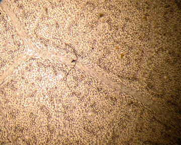 FRAL3-P_sdtree-2Oct-40X-06-5in