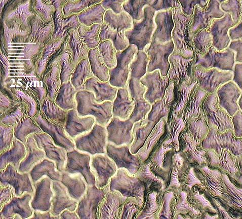 FRBE-BCk-dry-400x-35det-6in