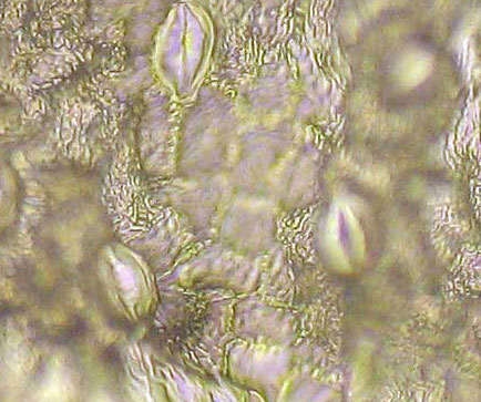 FRVE2-A6-448718-400x-22-5in