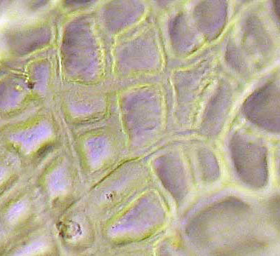 FRVE2-NM-7Oct-400x-06-5in