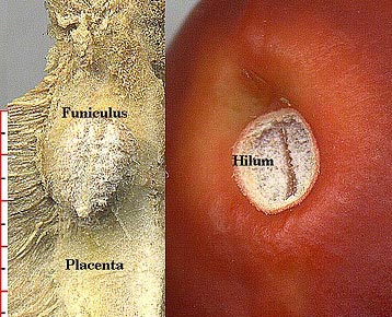 placenta & funiculus